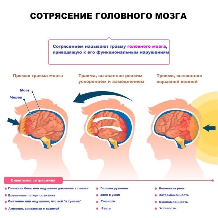 Сотрясение головного мозга: классификация, симптомы, диагностика