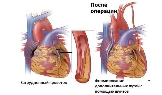 Что означает диагноз Е66.9?